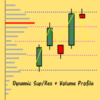 dynamic-level-volume-profile-logo-200x200-1394